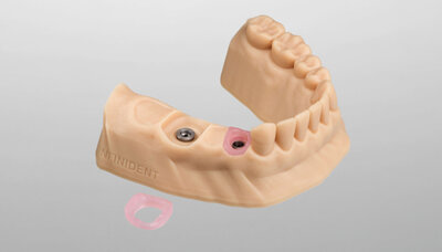 Implant models with flexible gingival masks now available from INFINIDENT