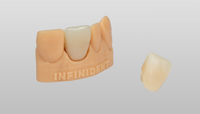 IPS e.max ZirCAD Prime Esthetic: now also available from us!